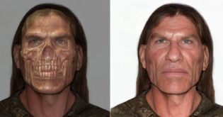 Scientists Reconstruct Face From Skyrim Skeleton